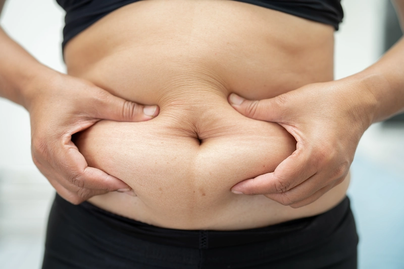 What does a cortisol belly look like